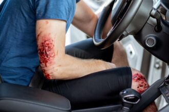 Conductor herido logra escapar y llegar a la exPosta por sus propios medios