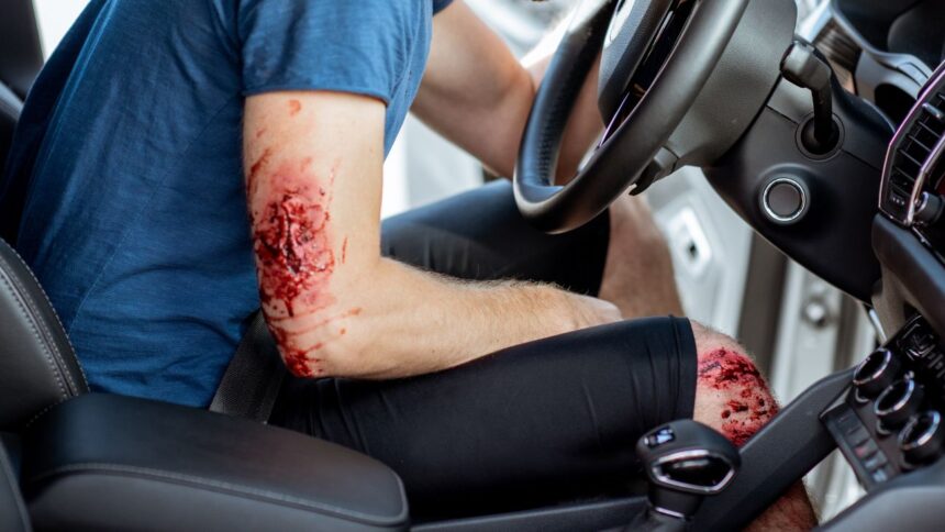 Conductor herido logra escapar y llegar a la exPosta por sus propios medios