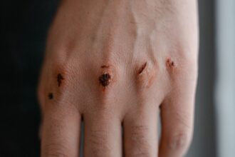 Mujer herida en femicidio frustrado en Estación Central