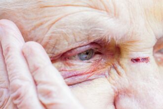 Violento robo en La Florida: Adultos mayores son agredidos y saqueados