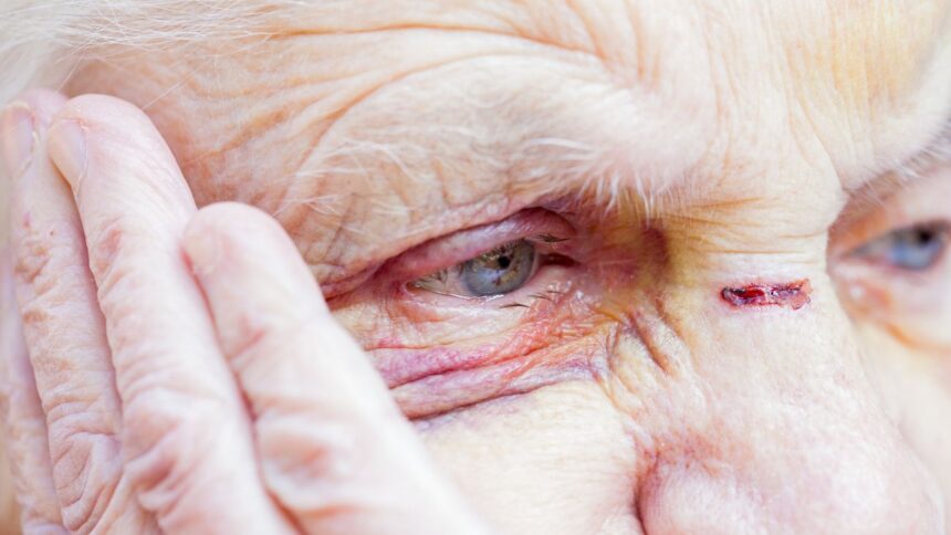 Violento robo en La Florida: Adultos mayores son agredidos y saqueados