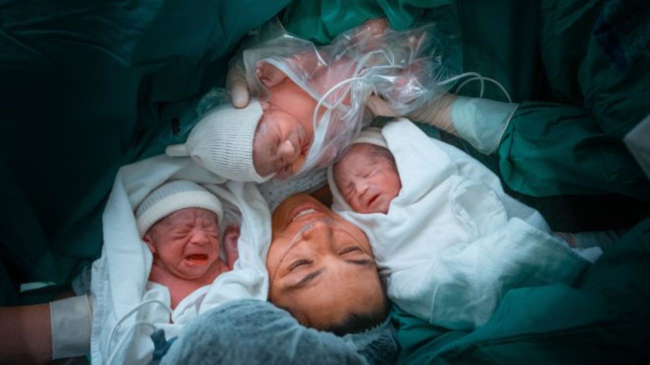 Sorprendente nacimiento de trillizos gemelares en Hospital Regional de Antofagasta