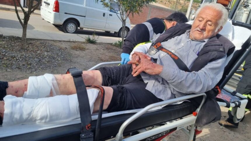 Ataques de perros en Recoleta: Vecino de 92 años resulta gravemente herido