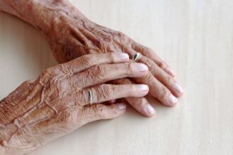 Mujer agredió a su madre con demencia senil