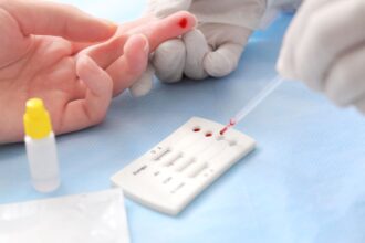 Jornada de testeo rápido de VIH en la Universidad de Chile