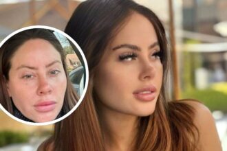 Ignacia Michelson revela transformación facial con ADN de salmón