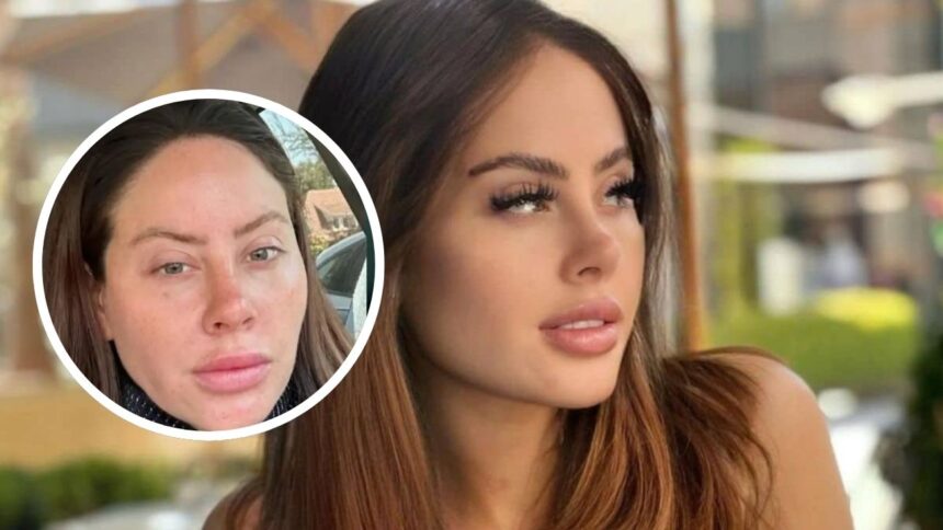 Ignacia Michelson revela transformación facial con ADN de salmón