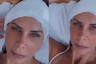 Modelo sufre grave accidente en hotel de Viña del Mar