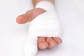 Joven en Valparaíso sufre graves quemaduras tras ataque con químico