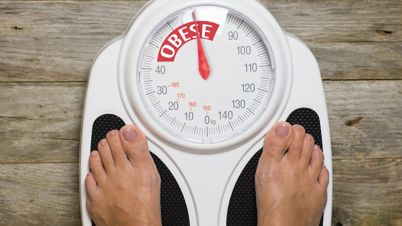 Chile: líder en obesidad en Sudamérica y próximamente en el mundo Chile: líder en obesidad en Sudamérica y próximamente en el mundo