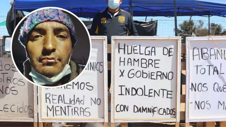 Huelguistas de Viña del Mar cosen sus bocas con piercings