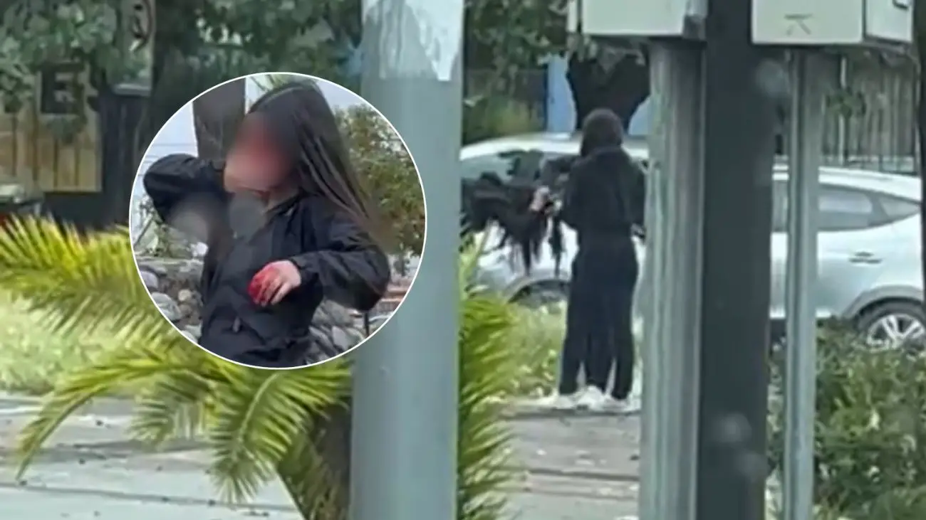 Violento ataque en Colegio Providencia de Parral deja estudiantes heridas