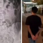 Detenidos en Aeropuerto de Santiago con 400 ovoides de droga