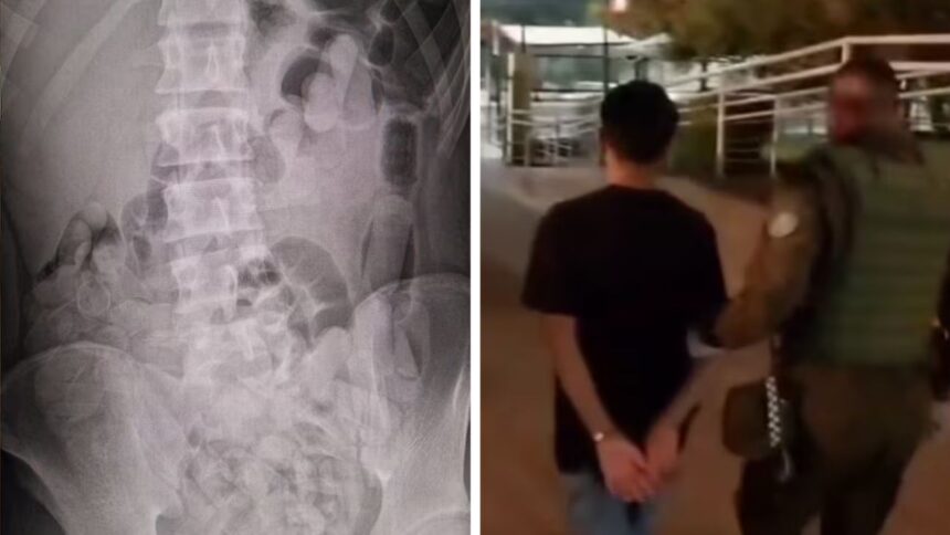 Detenidos en Aeropuerto de Santiago con 400 ovoides de droga