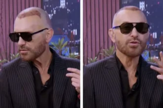 Jordi Castell se somete a injerto capilar en popular intervención estética