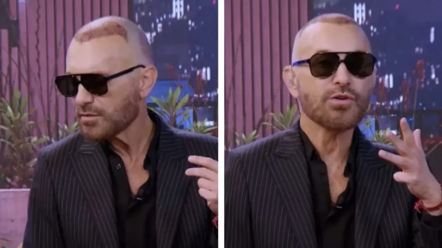 Jordi Castell se somete a injerto capilar en popular intervención estética