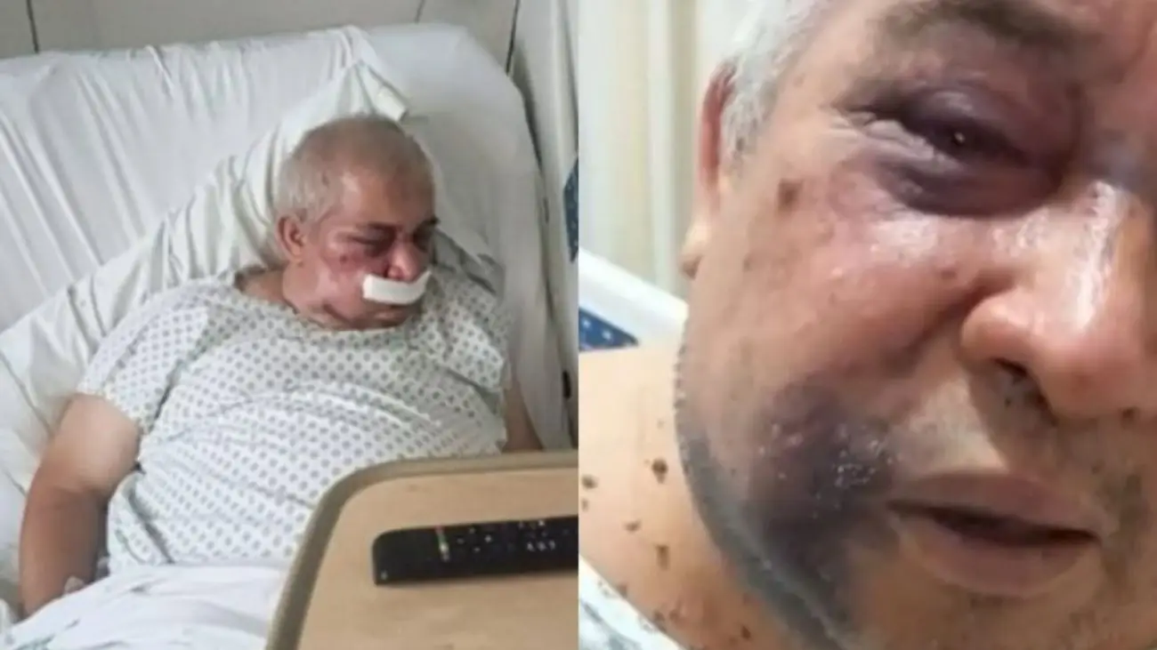 Brutal golpiza a conserje: temor ante represalias de agresor violento