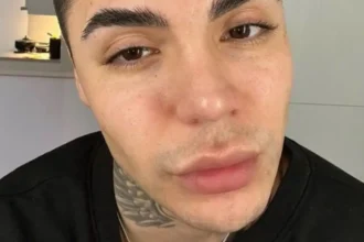 Leo Méndez Jr. revela diagnóstico de anorexia nerviosa antes de cirugías cruciales