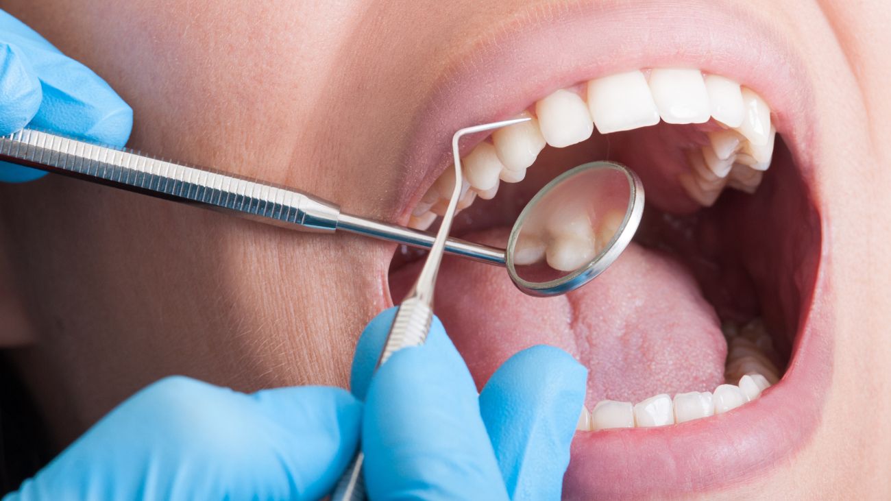 Caso del dentista sobreseído por prescripción despierta debate jurídico y médico Caso del dentista sobreseído por prescripción despierta debate jurídico y médico