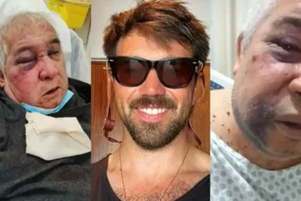 Conserje brutalmente golpeado en Vitacura exige justicia y cárcel para agresor