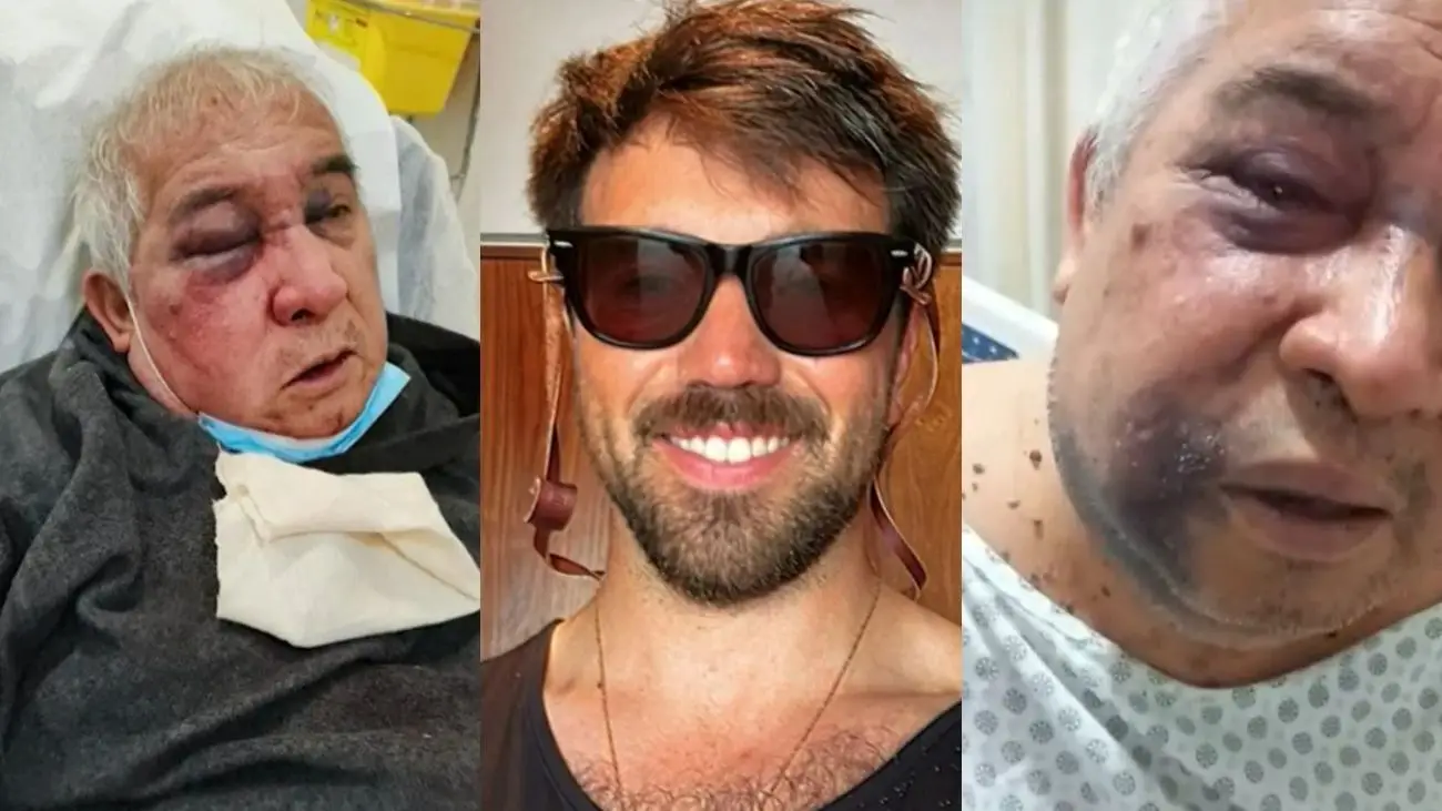 Conserje brutalmente golpeado en Vitacura exige justicia y cárcel para agresor