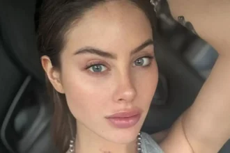 Ignacia Michelson revela que debe someterse a operación urgente de glúteos