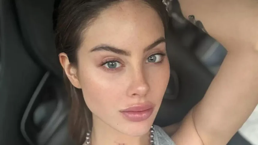 Ignacia Michelson revela que debe someterse a operación urgente de glúteos