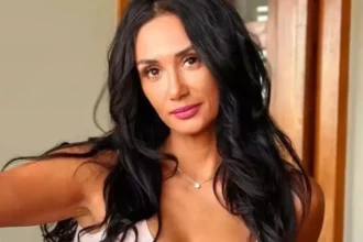 Pamela Díaz revela intervención ocular por chalación ¡Impacta a sus seguidores!