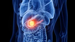 Conoce la verdad tras 9 mitos del cáncer de próstata que afectan a hombres