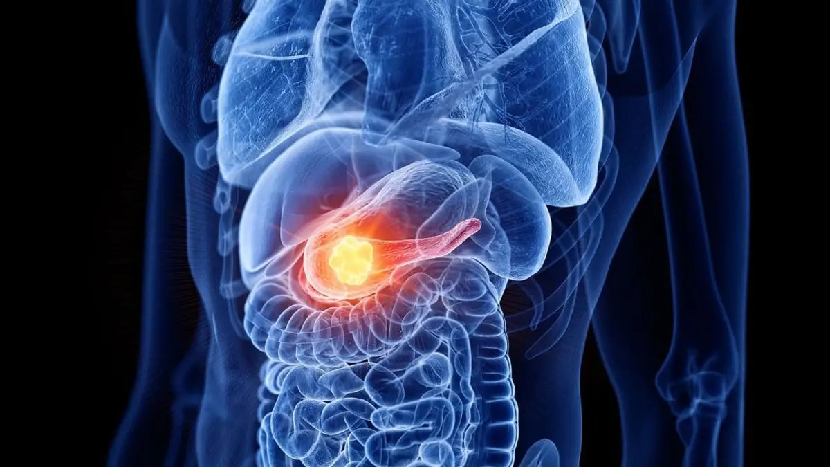 Conoce la verdad tras 9 mitos del cáncer de próstata que afectan a hombres Conoce la verdad tras 9 mitos del cáncer de próstata que afectan a hombres