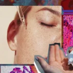 La lucha contra el melanoma: prevención y detección temprana son clave