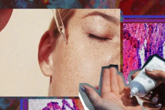 La lucha contra el melanoma: prevención y detección temprana son clave